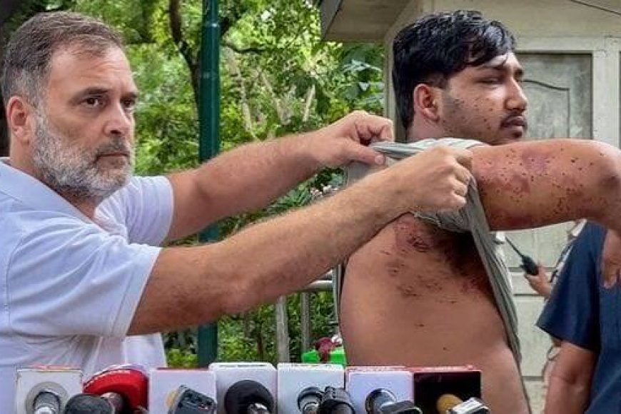 Ex-IPS officer, injured protesters move SC against pellet guns