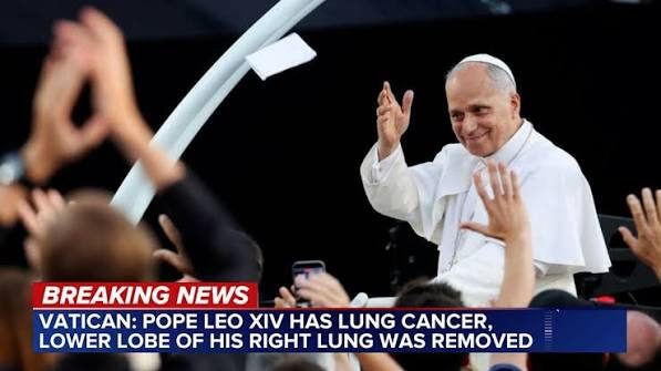 Vatican says Pope Leo XIV diagnosed with cancer; lower lobe of right lung removed
